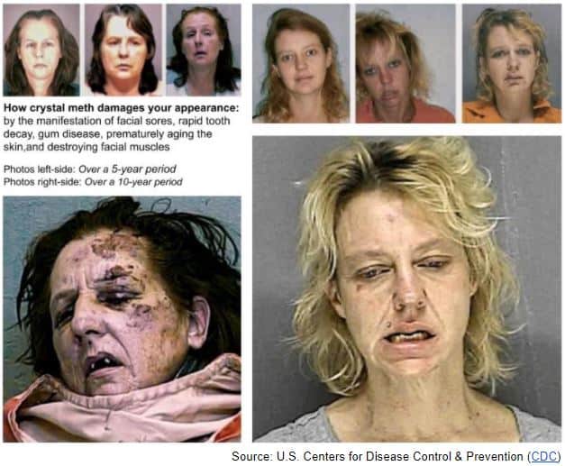 Meth female before and after pictures