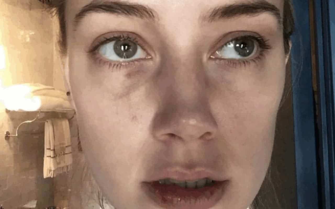 face